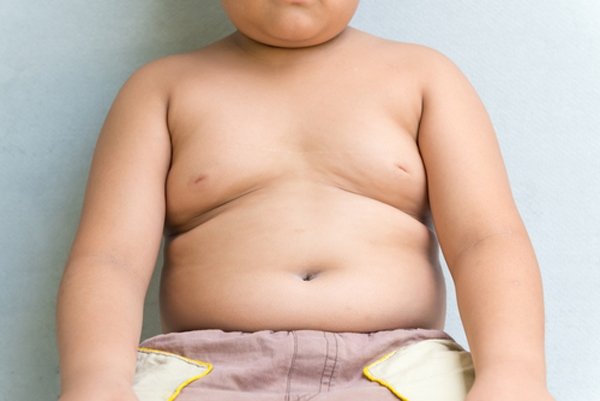 Лишний вес у детей